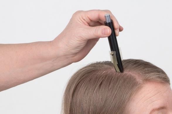 Is Your Scalp Healthy? – Scalp Health Evaluation Methods (Part I)